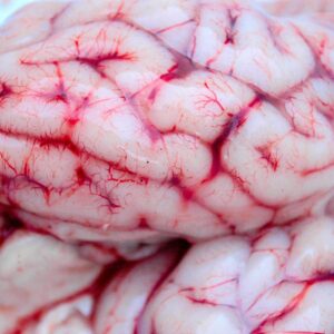 Brain & Nerves